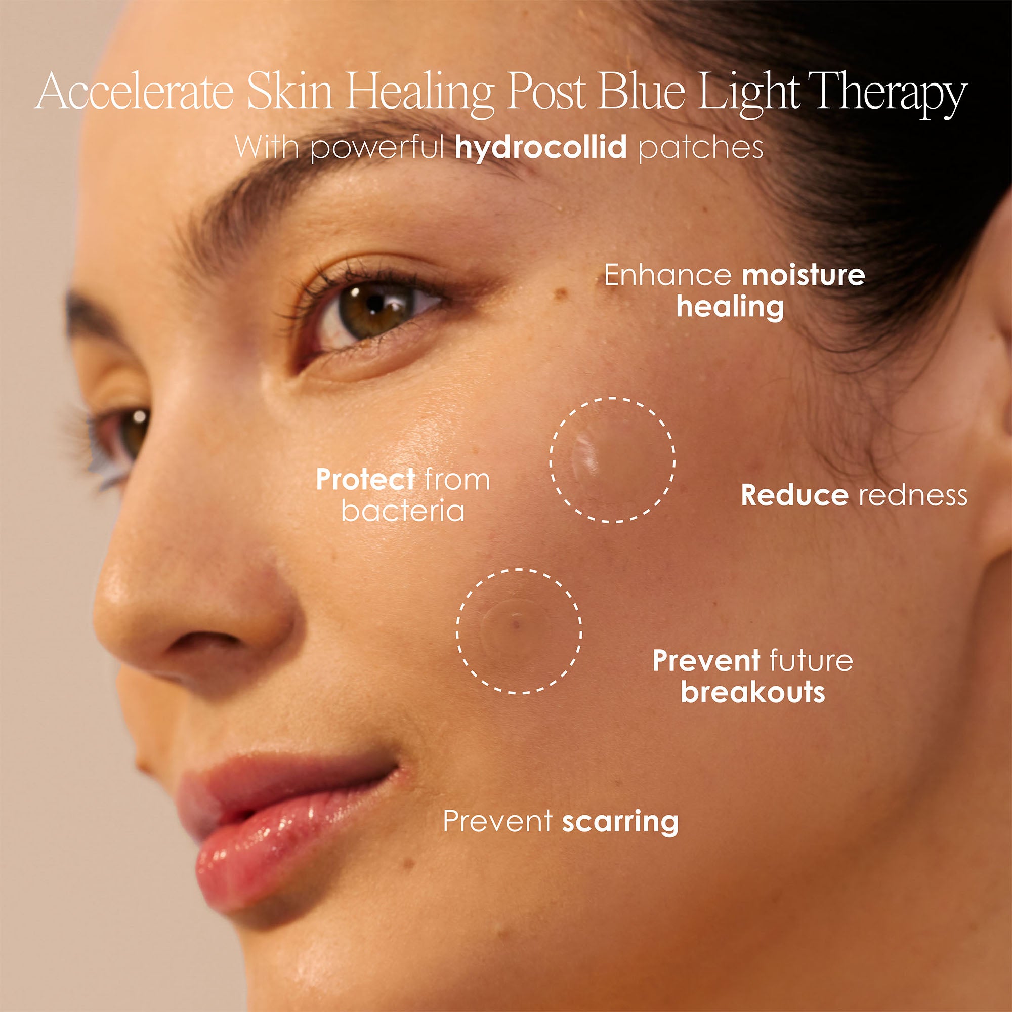 Clear + Glow Acne Patches (72 pcs)