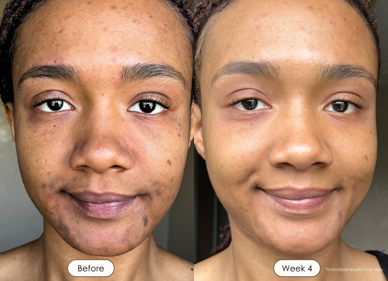 Before and after skincare comparison with visibly refreshed and glowing skin. 